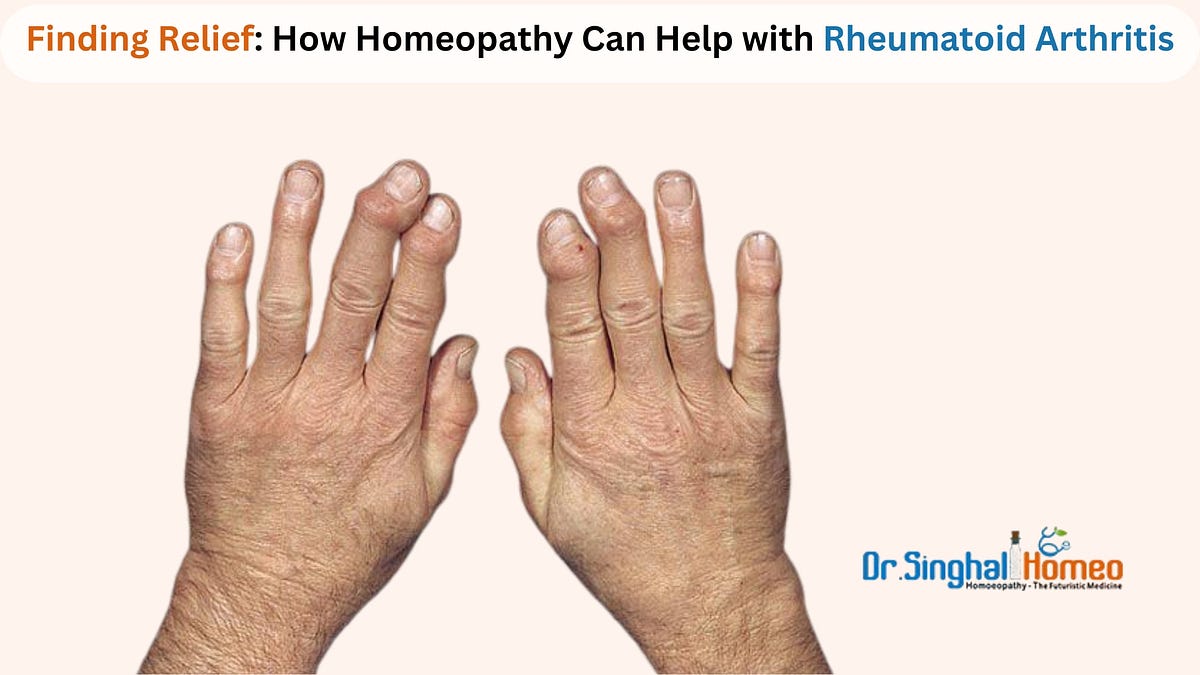 Finding the Best Doctor for Rheumatoid Arthritis Treatment: A Comprehensive Guide | by Dr. Singhal Homeo | Nov, 2024 | Medium